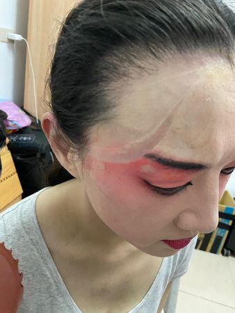 ▲▼ 茶金_李杏被頭飾勒超緊 勒到破皮 。(圖/公視提供)