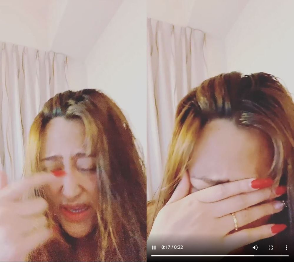 ▲家家眼睛受傷。(圖/翻攝自Instagram/jiajiachimusic)