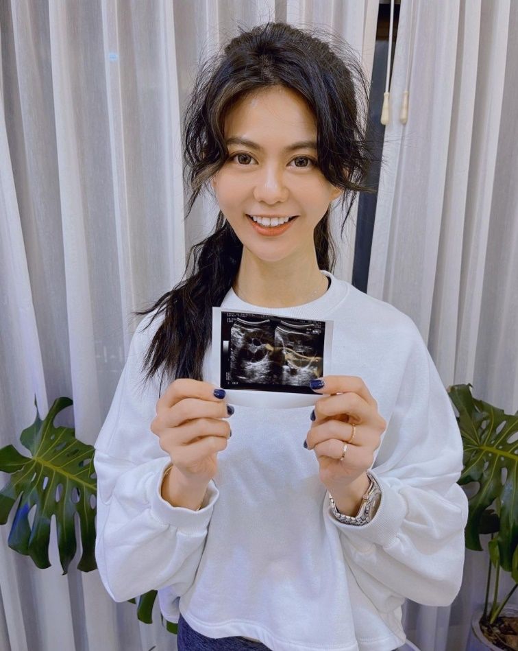 ▲白癡公主突曬「超音波照」　宣布凍卵一個月後…有好消息了！。（圖／翻攝自Instagram／87acup）