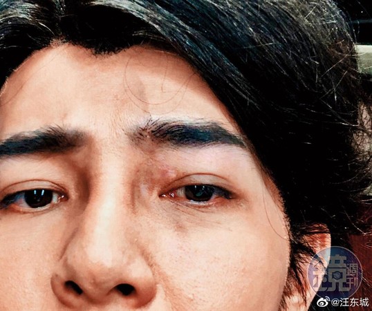 汪東城在大陸拍戲,之前拍攝古裝劇《干將莫邪》,不慎受傷破相。(翻攝自汪東城微博)